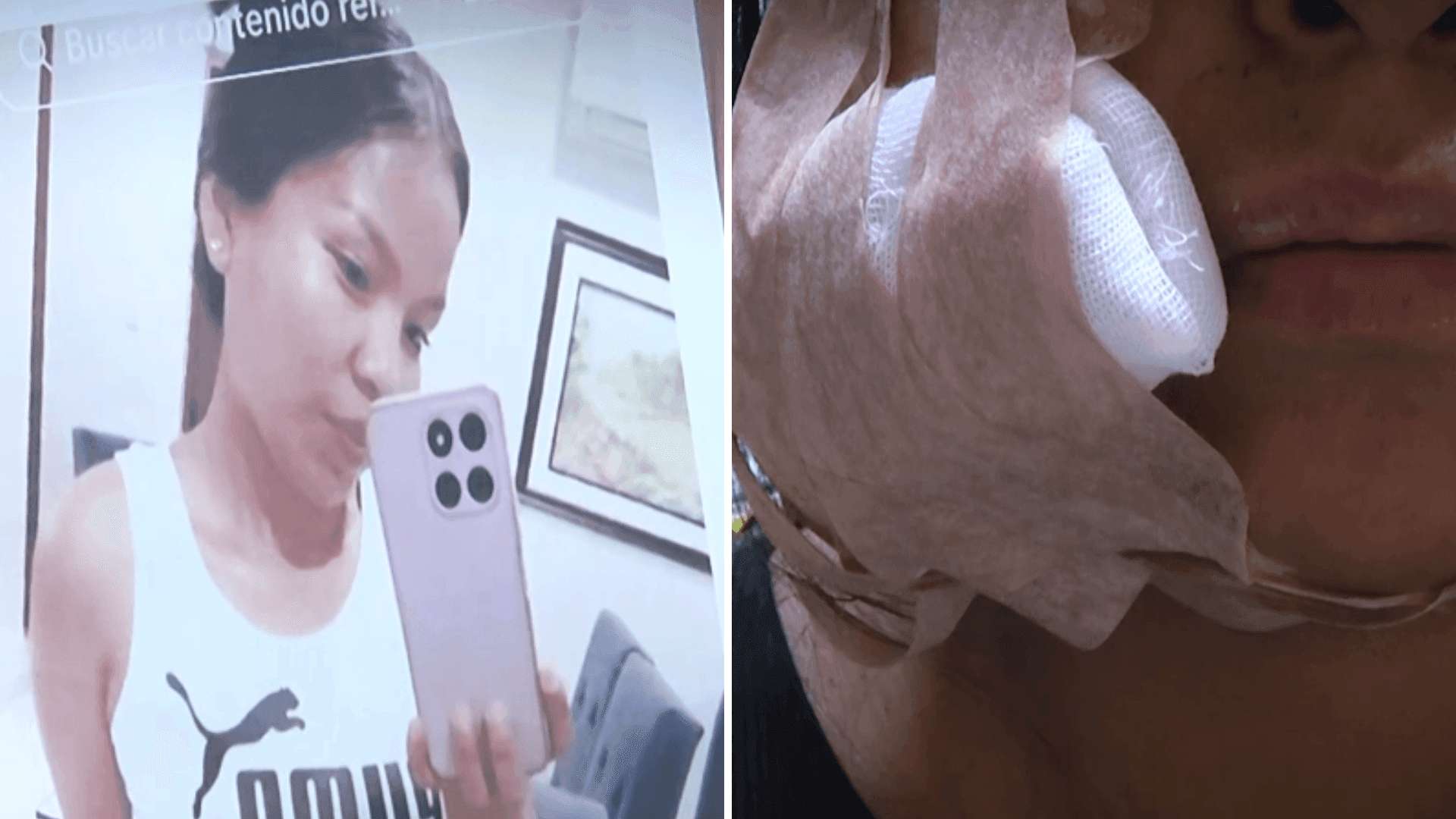 Fotografía de Juez libera a mujer que hirió el rostro de una joven: la víctima teme por su vida