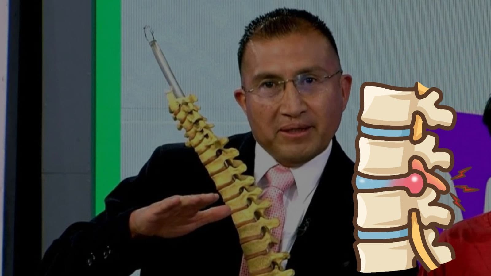 Fotografía de ¿Te duele la espalda baja? Podría ser una hernia de disco y estos son sus síntomas